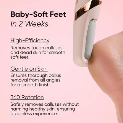Skynpeel - Foot Exfoliator & Callus Remover