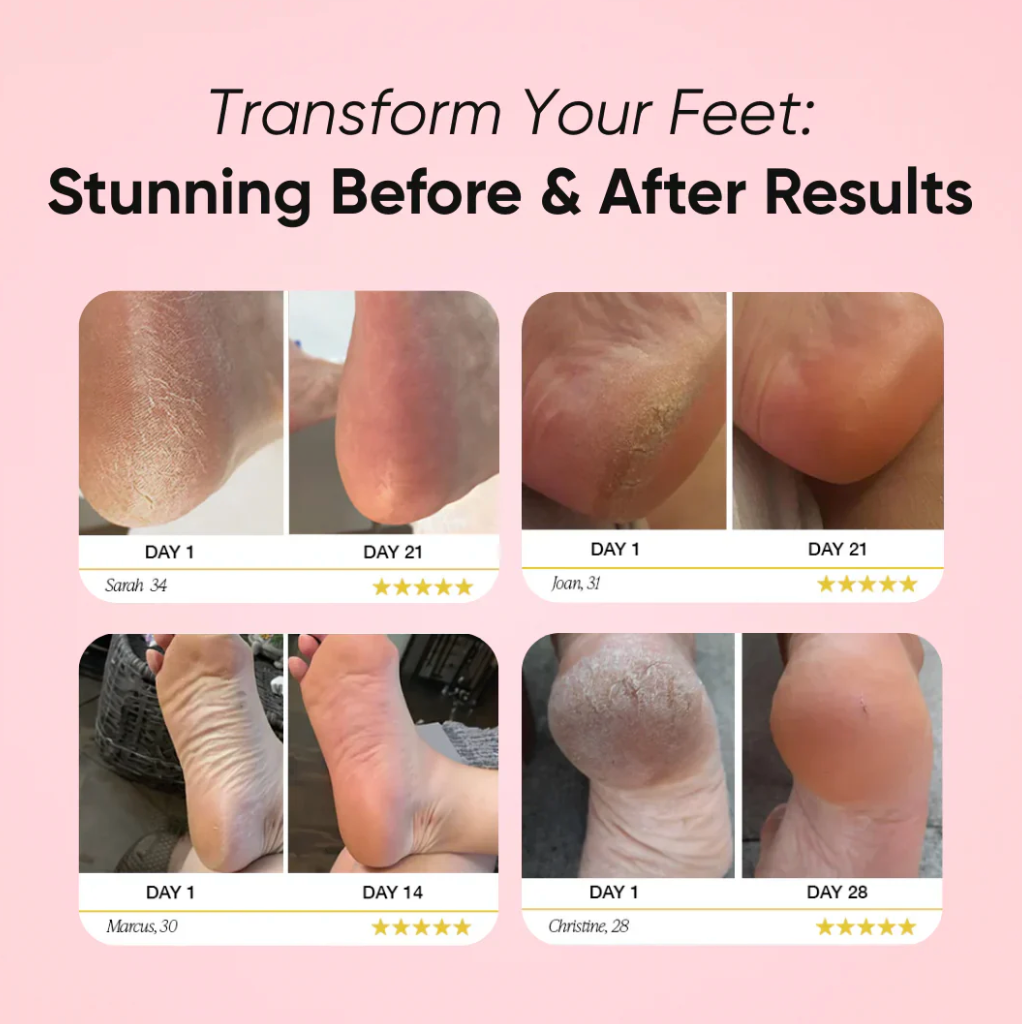 Step Confidently Into Baby-Soft Feet!